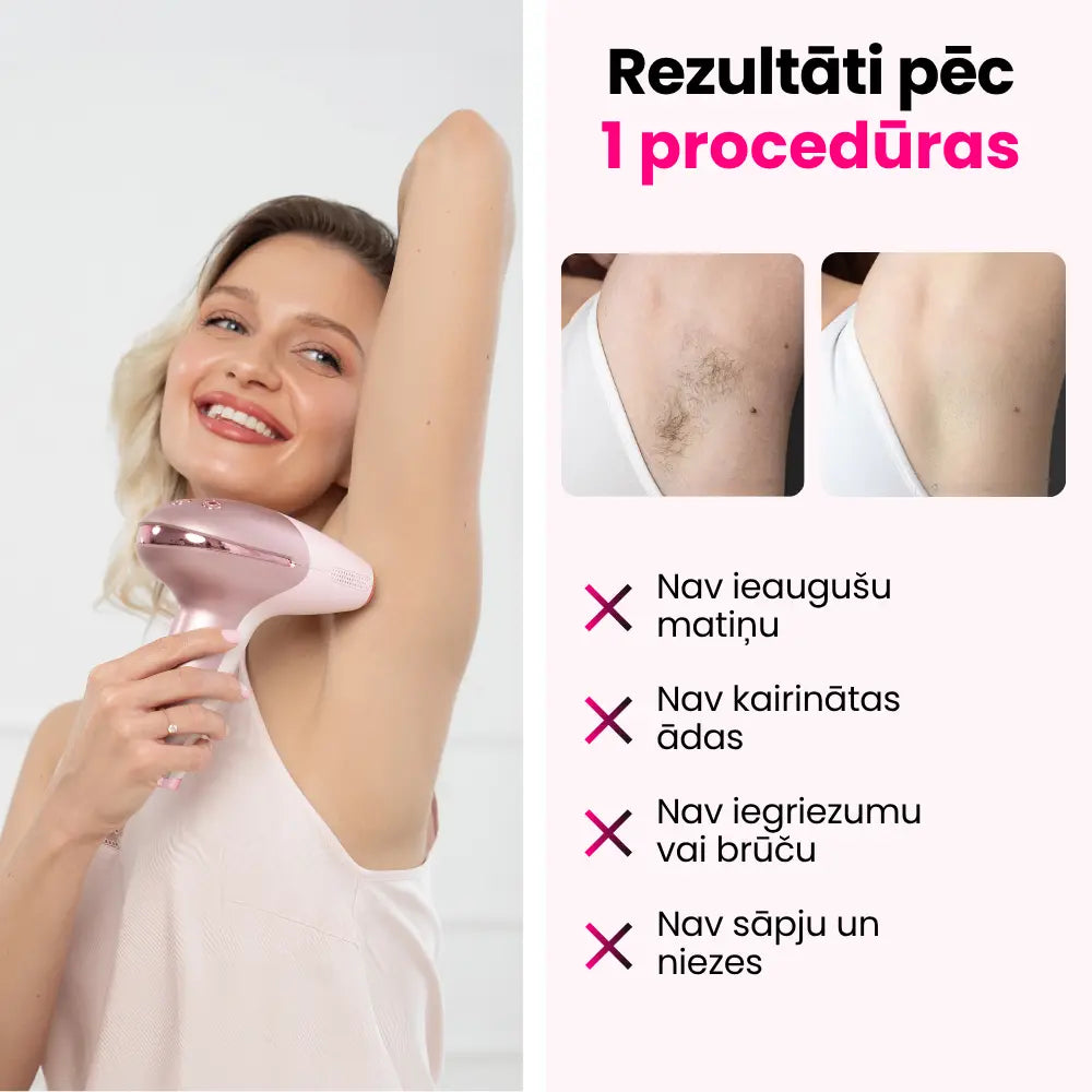 Elumi™ IPL matiņu noņemšanas komplekts